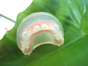 Invisible-Valplast-Denture